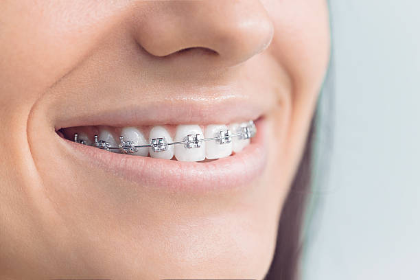 Why Choose Us for Your Dental Needs in Dalzell, SC